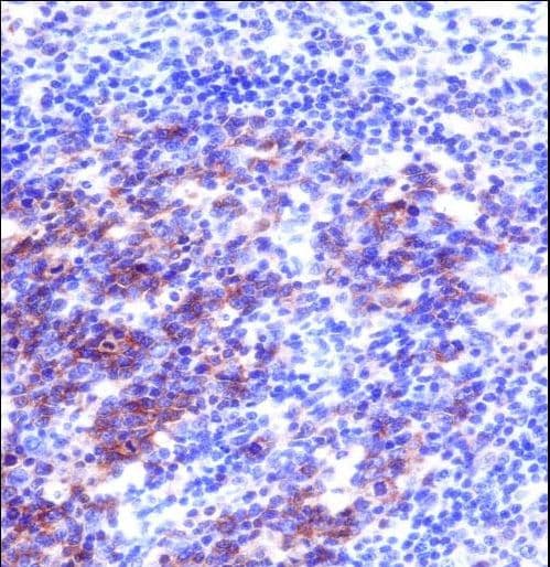 Polyclonal Rabbit anti-Human SNAP23 / SNAP-23 Antibody (aa170-199, IHC, WB)