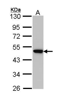 Polyclonal Rabbit anti-Human AP50 / AP2M1 Antibody (WB)