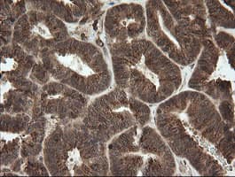 OTUB1 / OTU1 Antibody (clone OTI5F7)