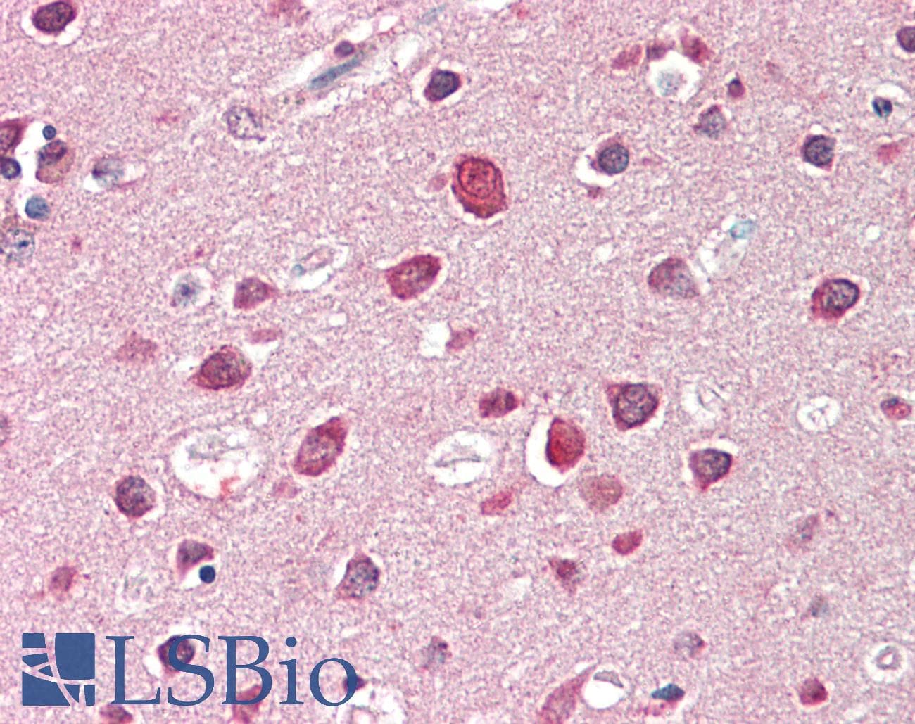 IHC-plus™ SH3GL2 Antibody (aa262-274)