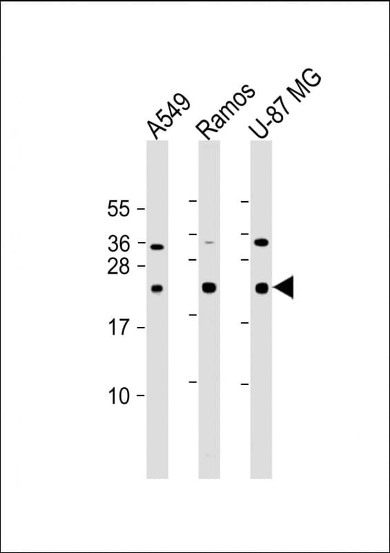 CD81 Antibody (clone 1668CT270.93.9)