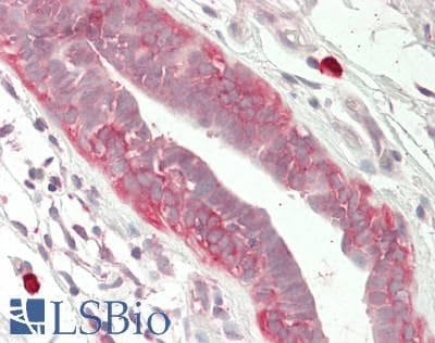 IHC-plus™ Nectin-1 / PVRL1 Antibody