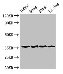 AP1G1 / Adaptin Gamma 1 Antibody