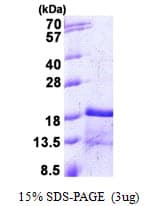 Mouse CCL2 / MCP1 Protein (Recombinant His)