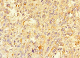 MORN5 Antibody