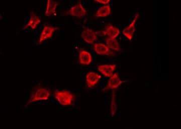 Polyclonal Rabbit anti-Human PTP1B Antibody (IHC, IF, WB)