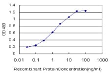 Monoclonal Mouse anti-Human RABIF Antibody (clone 2G3)