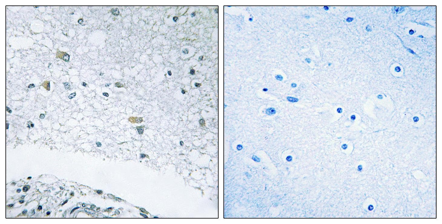Polyclonal Rabbit anti-Human LAMC3 / Laminin Gamma 3 Antibody (IHC, IF)