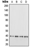 Polyclonal Rabbit anti-Human MAPRE3 / EB3 Antibody (C-Terminus, WB)