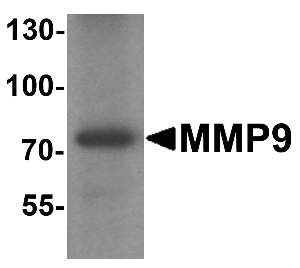 IHC-plus™ MMP9 / Gelatinase B Antibody