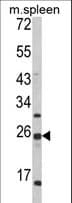 Polyclonal Rabbit anti-Human FKBP11 Antibody (aa159-188, IHC, WB)