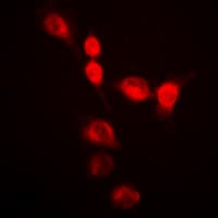 Polyclonal Rabbit anti-Human HNRNPA2B1 Antibody (N-Terminus, IHC, IF, WB)