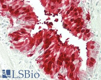 IHC-plus™ GSTA2 Antibody