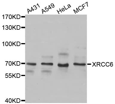 Polyclonal Rabbit anti-Human XRCC6 / Ku70 Antibody (IHC, IF, WB)