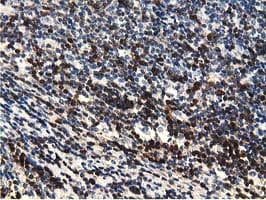 EPHX2 / Epoxide Hydrolase 2 Antibody (clone OTI1A6, Carrier-free)