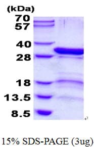 Human PSMD9 / 26S Proteasome Protein (Recombinant His)