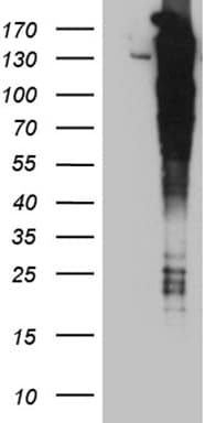 ARHGEF18 Antibody (aa118-215, clone OTI6G8)