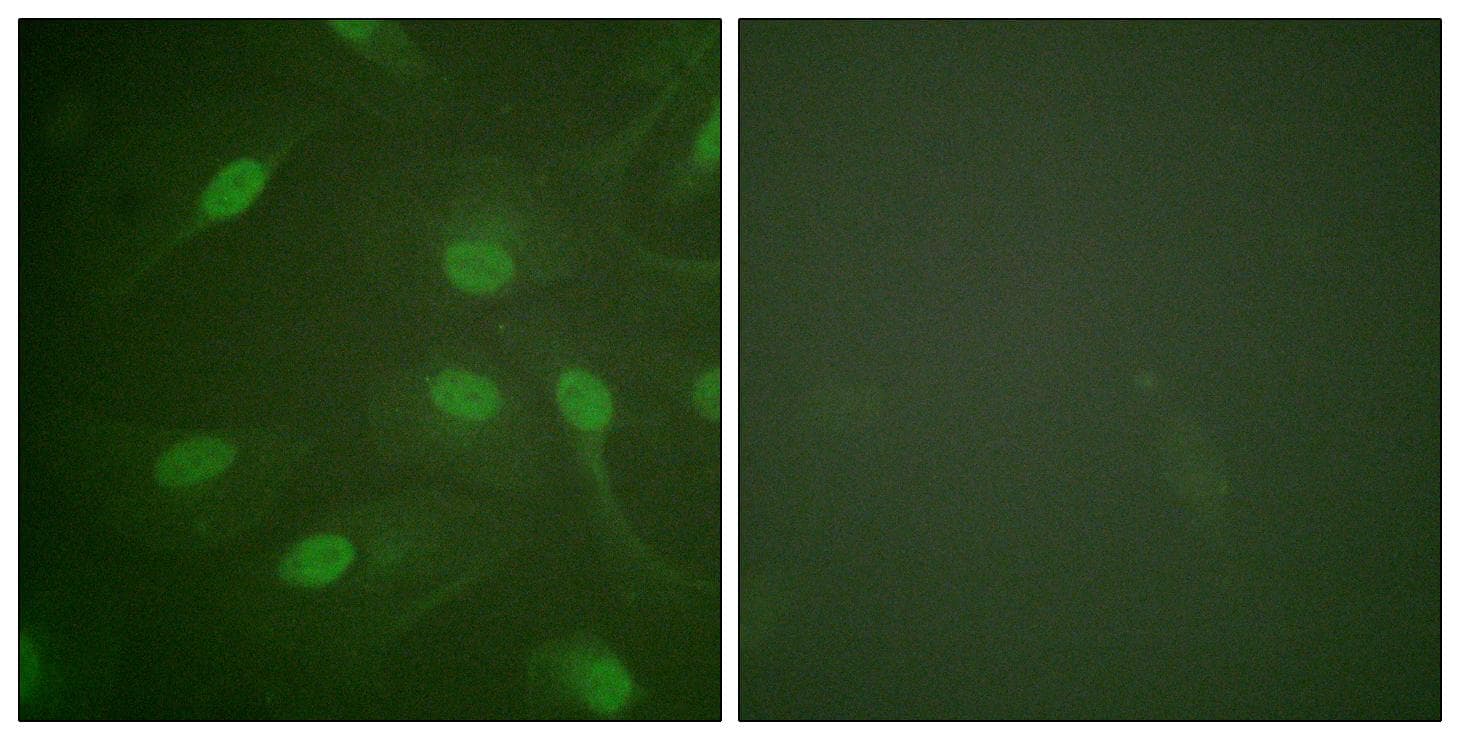 CHEK1 / CHK1 Antibody (phospho-Ser301)