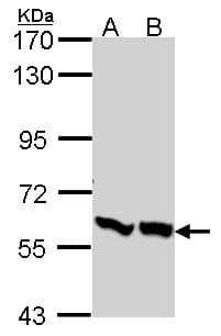 Polyclonal Rabbit anti-Human PFK2 / PFKFB3 Antibody (aa457-520, IHC, WB)