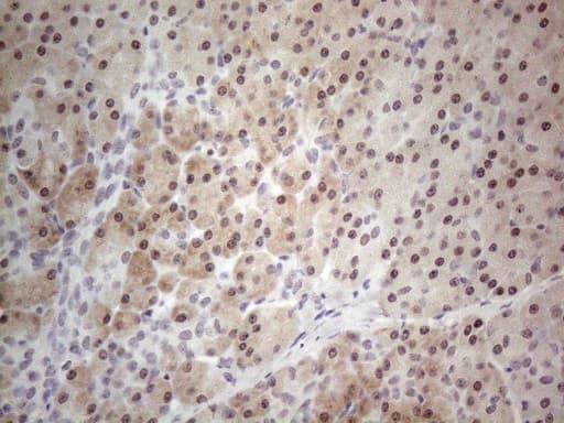 TDG / Thymine DNA Glycosylase Antibody (aa160-253, clone OTI3C11)