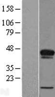 ACBD4 Protein (Over-Expression Lysate Myc-DDK (Flag))