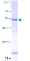 Human NSUN3 Protein (Recombinant GST)