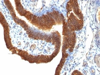 EPCAM Antibody (clone SPM491)