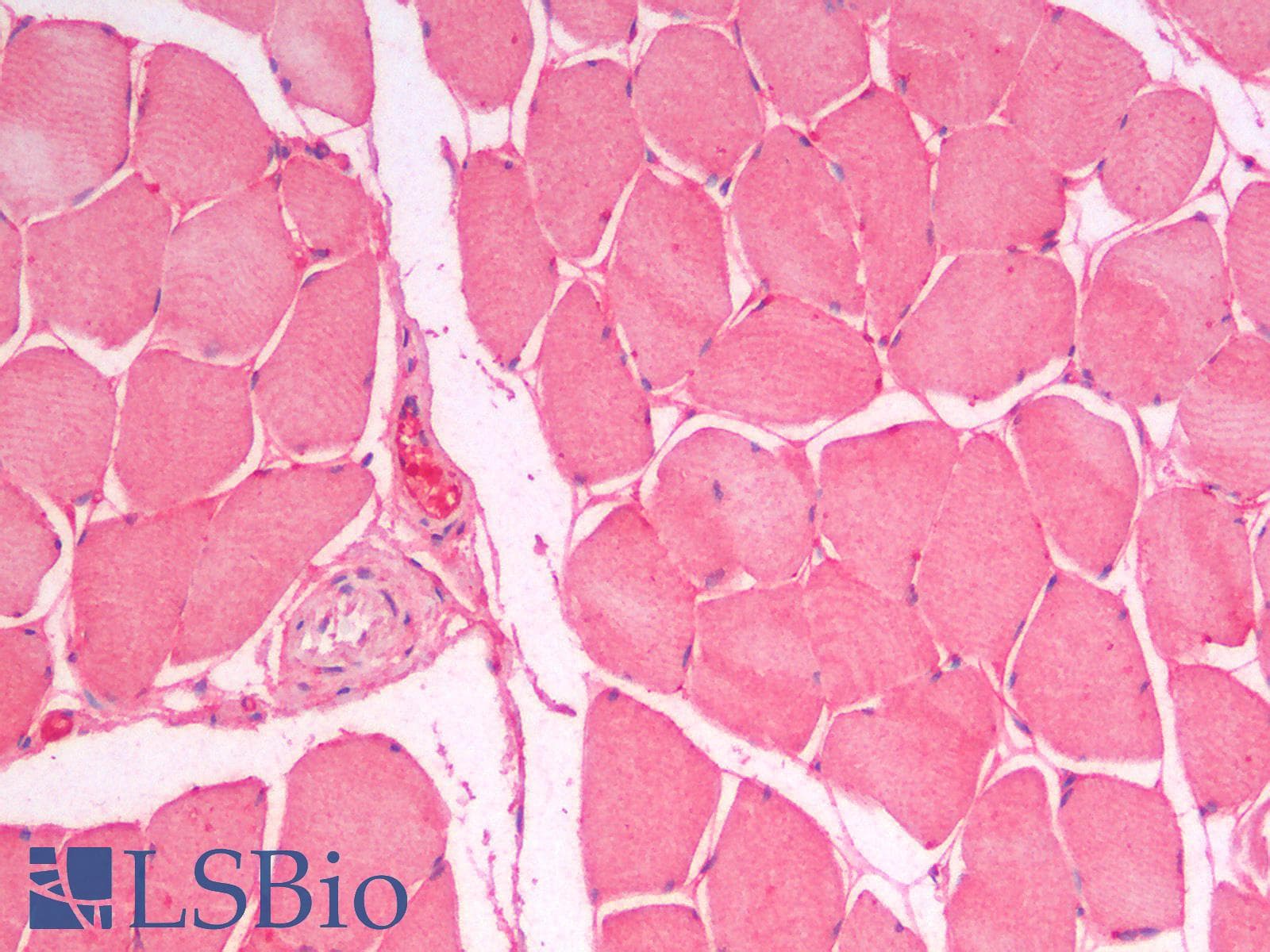IHC-plus™ SLC7A6 Antibody (C Terminus)