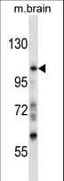 PRAGMIN / SGK223 Antibody (aa195-224)