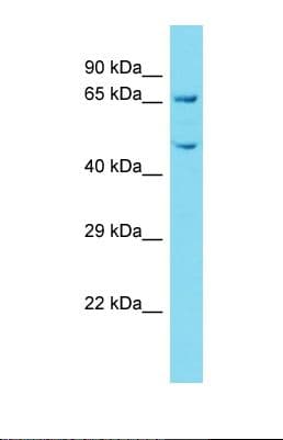 Polyclonal Rabbit anti-Human KBTBD12 Antibody (aa139-188, WB)