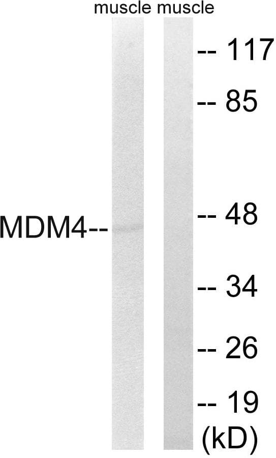 Polyclonal Rabbit anti-Human MDM4 / MDMX Antibody (Ab-367, IHC, WB)