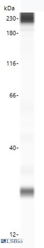 PathPlus™ TTR / Transthyretin Antibody
