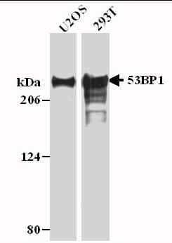 IHC-plus™ TP53BP1 / 53BP1 Antibody (aa350-400)