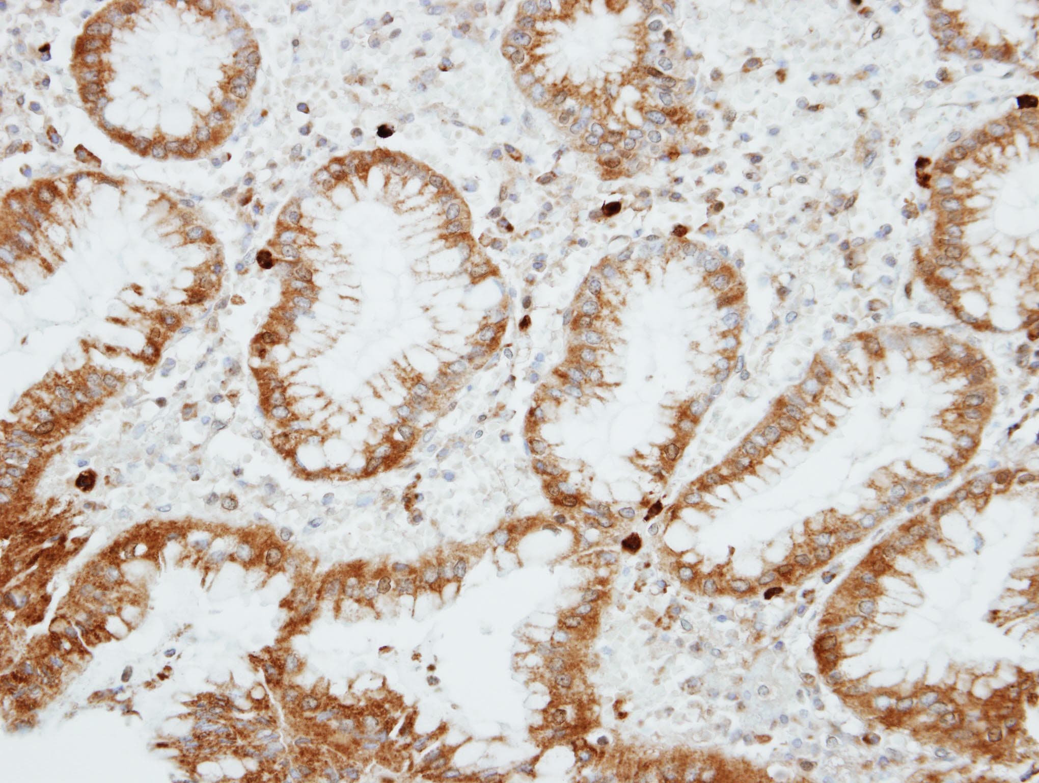 Polyclonal Rabbit anti-Human RGS14 Antibody (aa504-566, IHC, WB)