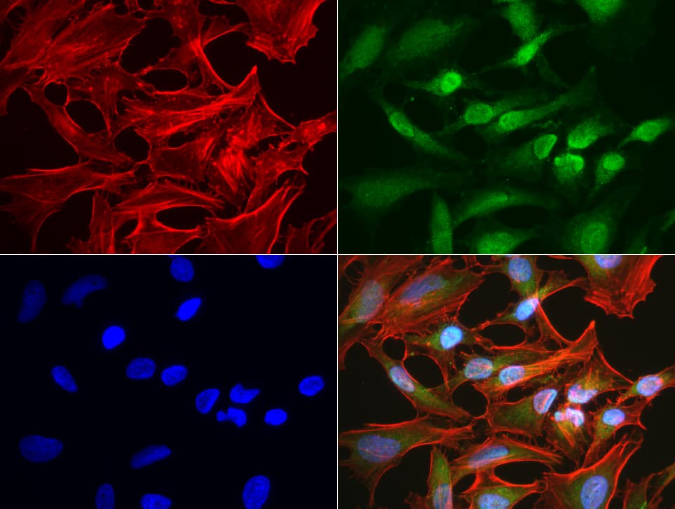 BBOX1 / BBOX Antibody (clone UMAB119, Carrier-free)