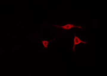 AMID / AIFM2 Antibody