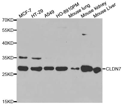 Polyclonal Rabbit anti-Human CLDN7 / Claudin 7 Antibody (IHC, IF, WB)