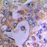 Polyclonal Rabbit anti-Human UCP2 Antibody (IHC, WB)