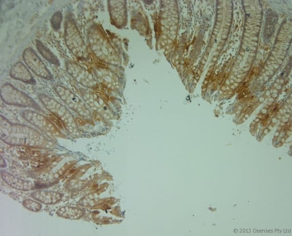 PLIN4 / S3-12 Antibody (aa1050-1100)