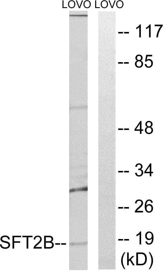 SFT2D2 Antibody