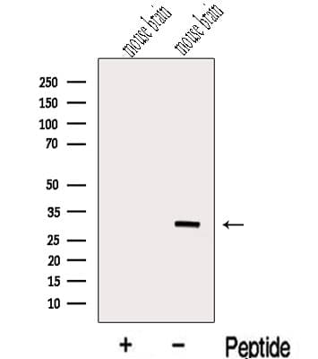 METTL1 Antibody