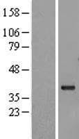 MLST8 / GBL Protein (Over-Expression Lysate Myc-DDK (Flag))