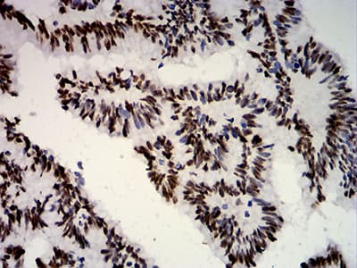 ER Alpha / Estrogen Receptor Antibody (clone 6A6F3)