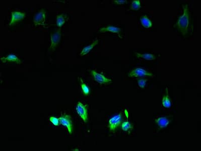 Polyclonal Rabbit anti-Human COA1 Antibody (IHC)
