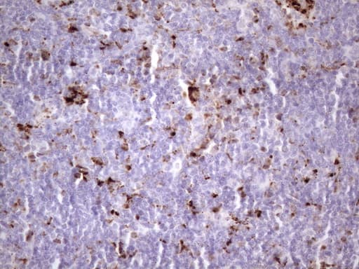 NR2C2 / TAK1 Antibody (aa1-241, clone OTI1B1)