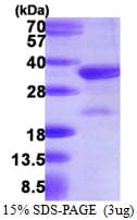 Human NEDF / VPS24 Protein (Recombinant His)