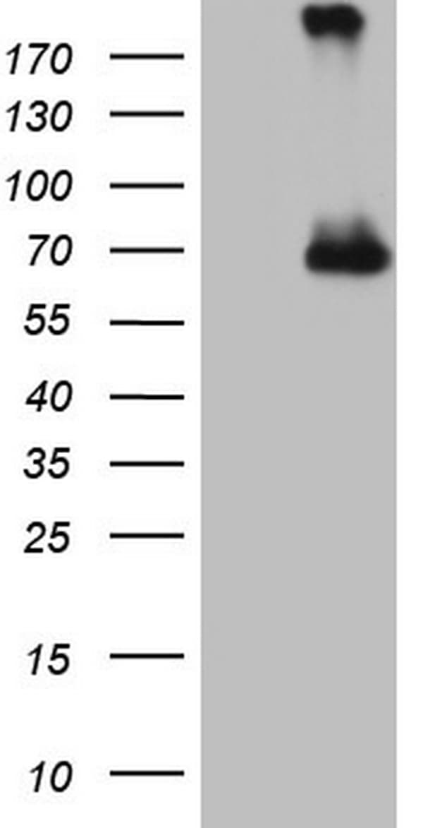 CFI / Complement Factor I Antibody (aa340-583, clone OTI2B5, Carrier-free)
