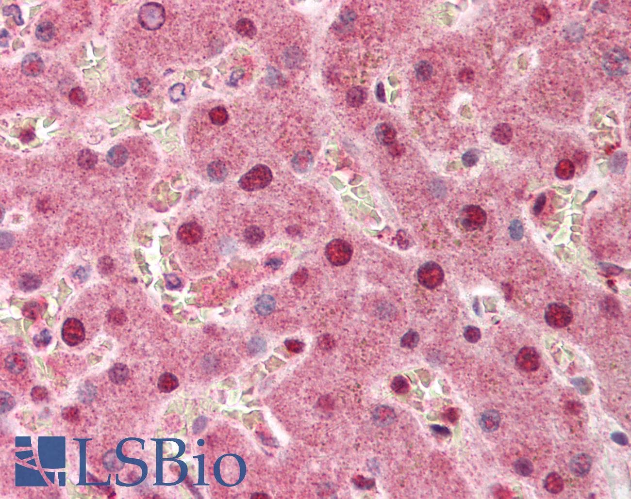 IHC-plus™ PPP1R13L / iASPP Antibody
