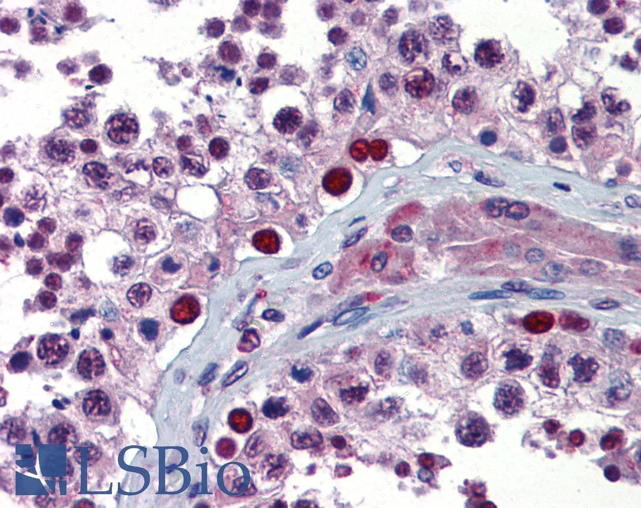 NFX1 Antibody (C-Terminus)