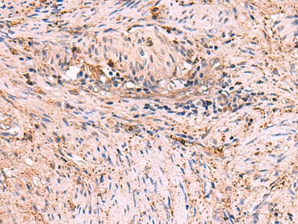Polyclonal Rabbit anti-Human MAPK8IP3 / JIP3 Antibody (IHC)
